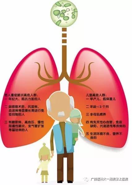 美国最新肺部健康资讯深度解读，关乎每个人的健康！