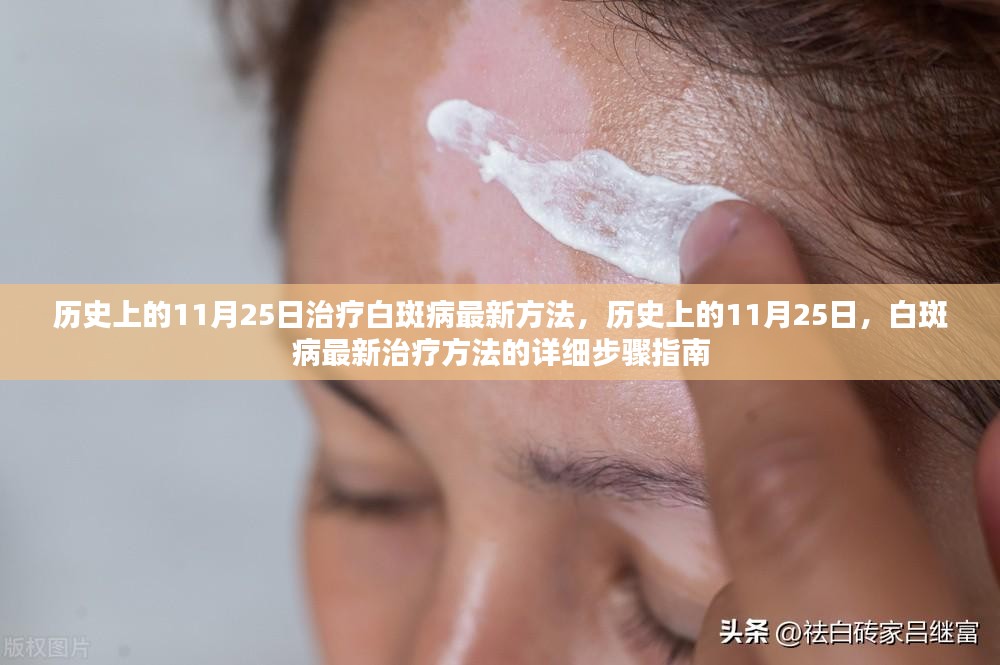 白斑病治疗最新技术，科技重塑生活希望